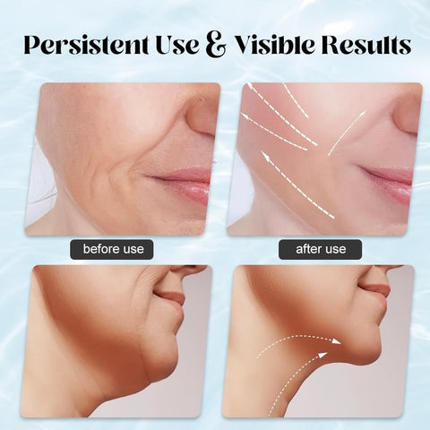 Remove Neck Wrinkles and Tighten Skin 3 in 1 LED Face Massager Skin Tightening Anti-Wrinkle Neck Lifting Beauty Device, Face & Neck Massager